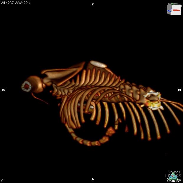 Pectus Excavatum in Kittens Update